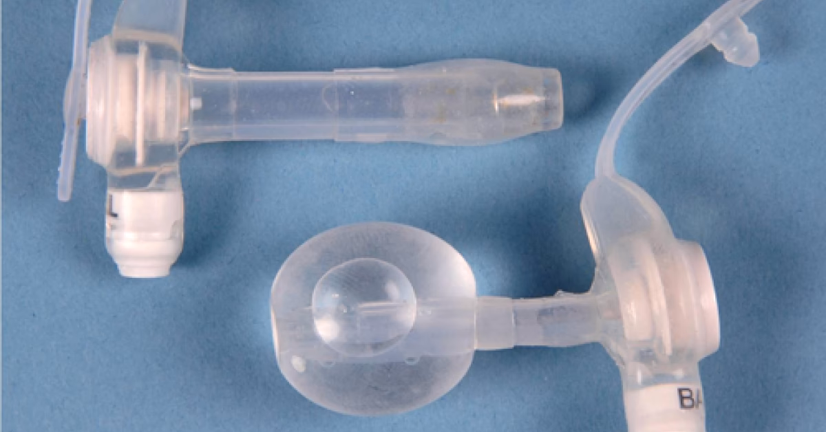 ¿Cuánto se puede vivir con botón gástrico?