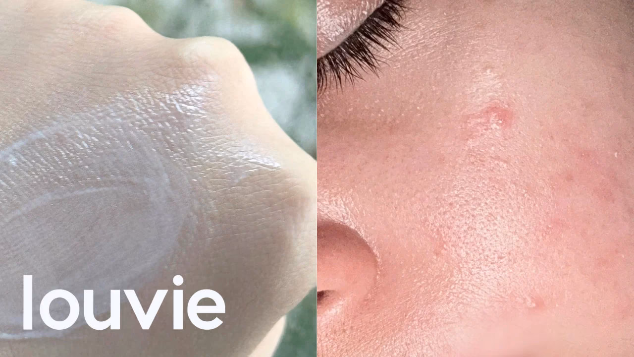 ¿Cuánto tarda en restaurarse la barrera cutánea?