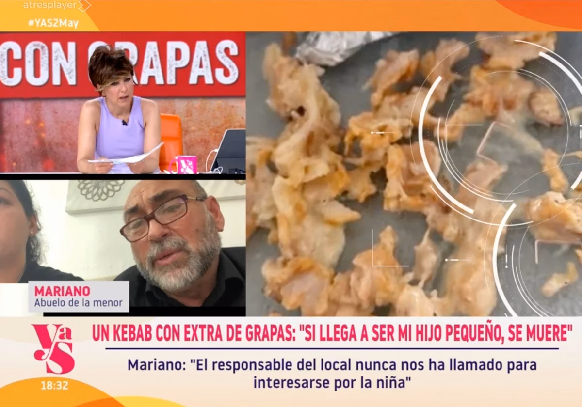 ¿Qué hago si me trago una grapa?