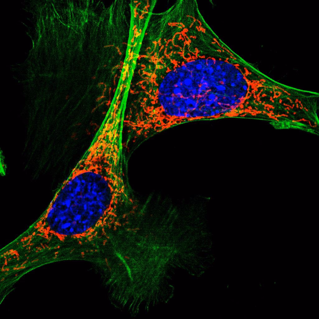 ¿Qué importancia tiene la alimentación en el correcto funcionamiento de la célula?