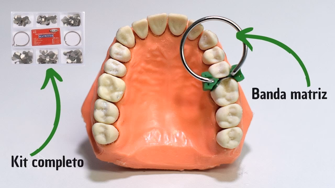¿Cuál es la función de las limas K en endodoncia?